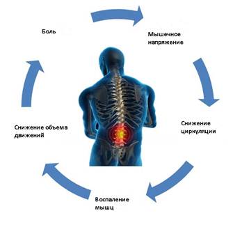 Стресс как причина болей в спине