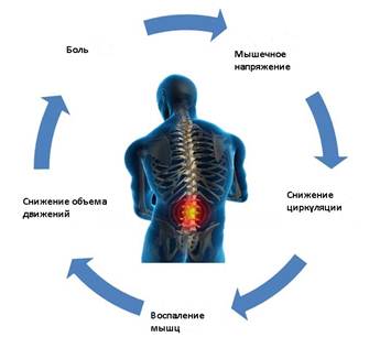 Как болит поясница при стрессе