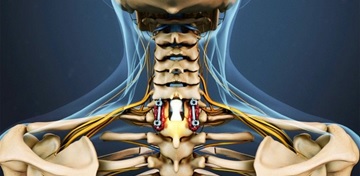 Дорсопатия шейного отдела позвоночника где лечить
