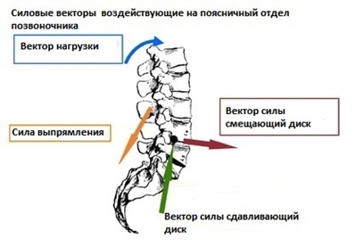Лечение протрузии поясничного отдела позвоночника дикуля