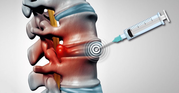 Уколы от грыжи позвоночника в москве