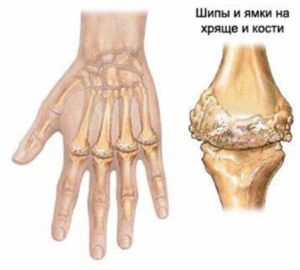 Где Находятся Суставы У Человека Фото