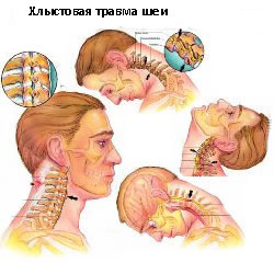 Где Находится Теменная Область Головы Фото