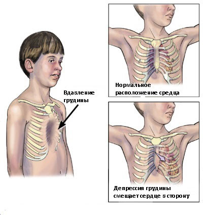 Грудная Клетка Человека Фото