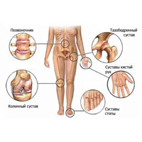 Лечение суставов