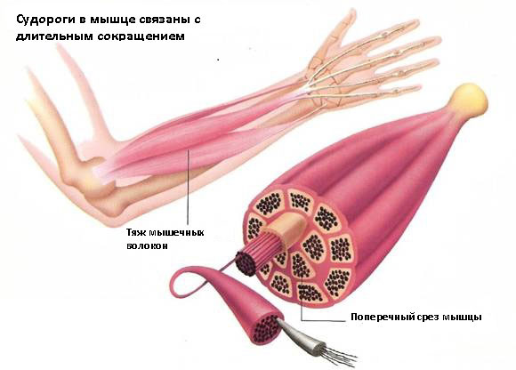 Мышечные судороги - лечение, симптомы, причины, диагностика | Центр Дикуля