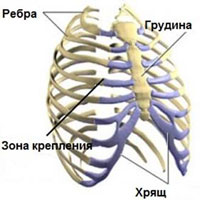 Реберный хондрит (синдром Титце)