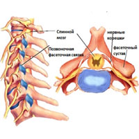 Синдром фасеточных суставов