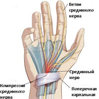 Определение и основные причины