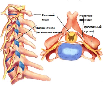 Синдром фасеточных суставов